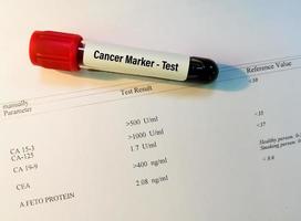 Blood sample for cancer marker including CA 125, CA 15.3, CA 19.9, AFP and CEA test with laboratory report. Tumor marker test. photo