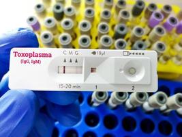 Rapid test cassette for Toxoplasma Antibody test. toxoplasma gondii photo