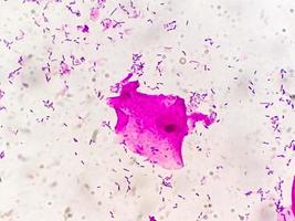 Gram staining, also known as Gram's method, is a method of differentiating bacterial species into two large groups called Gram positive and Gram negative. photo