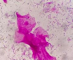 Gram staining, also known as Gram's method, is a method of differentiating bacterial species into two large groups called Gram positive and Gram negative. photo