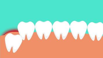 tand som trycker från insidan och ger smärta till tandköttet 4k-animation. farlig visdomstandvärk orsakar tandköttssmärtor. en visdomstand tränger igenom tandköttet och ger en röd smärtsignalanimation. video