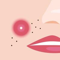 Woman with pimples on her face. Vector illustration in flat style