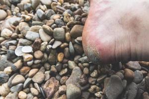 Bare heel of a person lying on water worn pebbles photo
