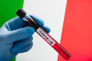 alerta epidémica. brote de coronavirus en italia. analice la muestra de sangre en la mano usando guantes médicos contra la bandera italiana. trabajador de la salud sostiene un tubo de ensayo