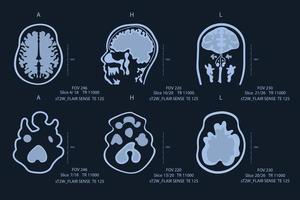 Elderly man brain scan image on MRI magnetic resonance imaging film for neurological medical diagnosis of brain . vector