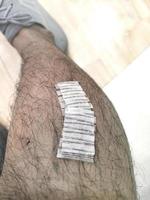 adhesive bandage on the lower leg photo