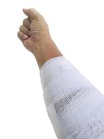 Arms, elbows with injured bandage Because of accident isolated On a white background photo