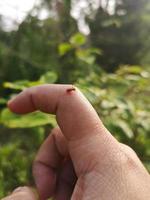 A mosquito is biting and sucking blood on the index finger photo