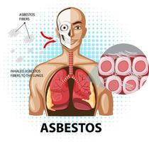 diagrama que muestra la asbestosis en los pulmones vector