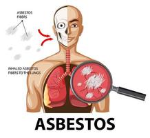 diagrama que muestra la asbestosis en los pulmones vector