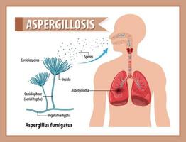 diagrama que muestra la infección por aspergillus vector