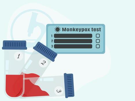 Monkey pox analysis, a set of test tubes with blood for research and a card for recording results vector