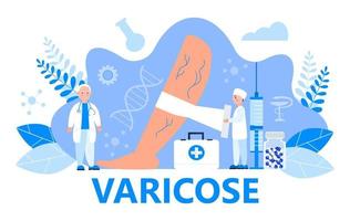 vector de concepto de venas varicosas para sitio web médico. pequeños cirujanos, terapeutas tratan enfermedades vasculares, aplican vendajes ajustados.