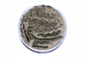 Biochemistry research test fungus growing petri dish. photo