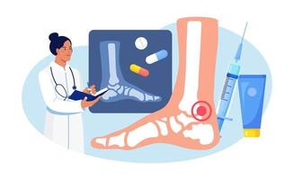 artritis del pie del tobillo. médico examinando imágenes de rayos X de las articulaciones. osteoartritis, artritis reumatoide, enfermedad reumática. el médico trata el dolor articular del paciente vector