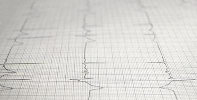 gráfico de cardiograma con primer plano de la mesa médica, para el registro cardíaco del cirujano, enfoque selectivo foto