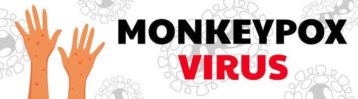 Monkeypox virus poster. Web banner of monkey pox skin infection of person. Vector Illustration.