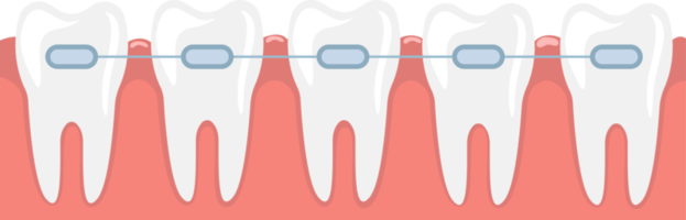 Braces clipart design illustration png