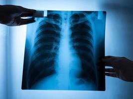 Specialist doctor examining x-ray film of patient. photo