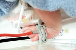 Sick newborn crisis baby foot Insert a Oxygen strap and saline to measure oxygen in the blood and see the oxygen value for organs. photo