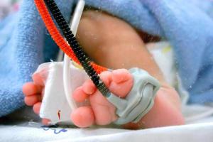 Sick newborn crisis baby foot Insert a Oxygen strap and saline to measure oxygen in the blood and see the oxygen value for organs. photo