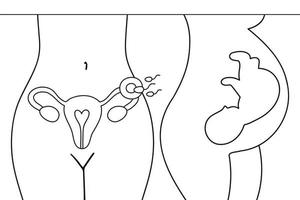 útero, esperma, inseminación. fecundación en la trompa de Falopio. embrión en el vientre de la mujer. ginecología, reproductiva. Posiciones fetales del bebé en el útero durante el embarazo. vector