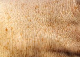 skin of the human hand photo