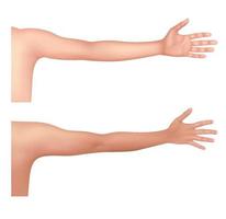 Healthy human arm of the Asian people. Front and back view for advertising medical publications. Fitness and health concept. On a white background. 3D vector EPS10.