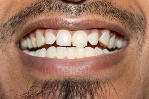 Happy smile with teeth macro close-up view photo