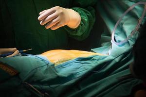 incisión de esternotomía cerrada con sutura foto