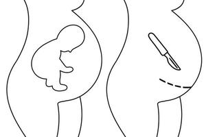 Fertilization thin line icon. Uterus, sperm, insemination. Fertilization in the fallopian tube. Embryology. vector