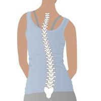 Tipos de deformación de la columna vertebral y afiche de diagrama de comparación de la columna vertebral saludable con curvaturas de la columna vertebral. perfil femenino y vista posterior. información quiropráctica. vector