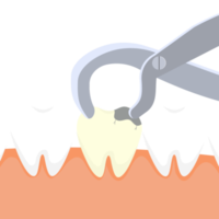 dentista che estrae un dente morto con l'attrezzatura. attività di cura dentale con una pinza da dentista e un vettore di denti morti. illustrazione di estrazione del dente morto. concetto di rimozione dei denti. png