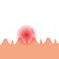 död tand gör ont och ger en röd smärtsignal koncept. en dålig tand med hål och en röd farosignal. dental infographic element vektor med en död tand. stomatologisk vård för tänder. png