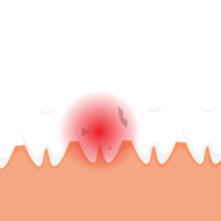 Diente muerto lastimando y dando un concepto de señal de dolor rojo. un diente malo con caries y una señal de peligro roja. vector de elementos infográficos dentales con un diente muerto. estomatología cuidado de los dientes. png