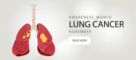 pancarta informando sobre el cáncer de pulmón. plantilla de diseño para sitios web, revistas. estilo de dibujos animados de ilustración vectorial. vector