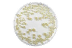Top view of petri dish and culture media with bacteria on white background with clipping, solid media, nutrient agar, Test various germs, virus, Coronavirus, Corona, COVID-19, Food, Food science.
