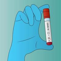 The laboratory assistant holds a test tube with the patient analysis. Diagnostics passed. Coronavirus infection COVID19 detected. The blood sample is positive. Isolated background. Vector illustration