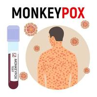 Monkeypox pandemic poster. Smallpox man, test tube with blood with a positive test and virus cells. Viral disease. Vector illustration.