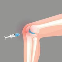 Knee injection inflamation redness vector illustration