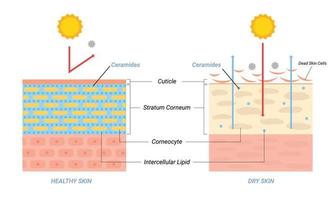 ilustración de capa de piel seca y saludable. concepto de belleza y cuidado de la piel vector