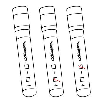 Diagnosis of blood samples for monkeypox virus. Sketch. Test tubes with patient tests. Set of vector illustrations. Three results positive, negative, unfinished.