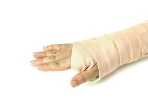 Broken arm to broken wrist from accident isolated on white background photo