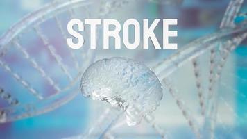 The brain and stroke word for health or sci concept 3d rendering photo