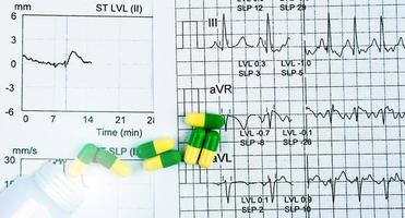 Green-yellow capsule pills spread out of white plastic drug bottle on EKG or ECG graph report paper. Medicine effect on cardiac function. Heart medication concept. Pharmacology. Prescription drugs. photo