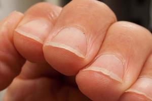 Man whose fingernails need to be trimmed and cleaned photo