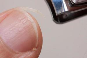 Man trimming his fingernails with a pair of nail trimmers photo