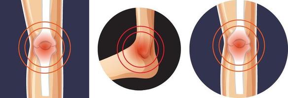 Human bone joint concept vector