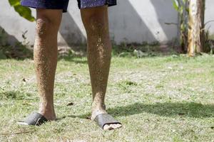 A man's legs were dirty with grass clippings. because he wears shorts to mow the grass on the lawn without wearing protective clothing. photo