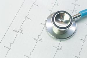 Blue stethoscopes and  Electrocardiography  chart close up image. photo